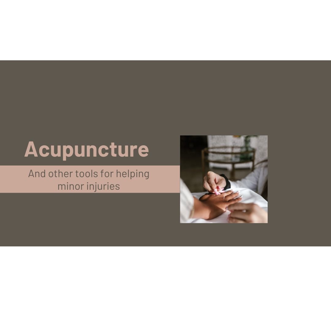 Acupuncture - And other tools for helping minor injuries