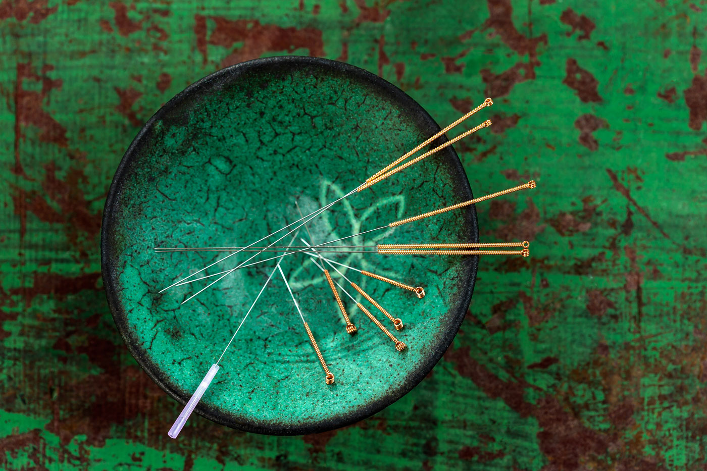 Acupuncture