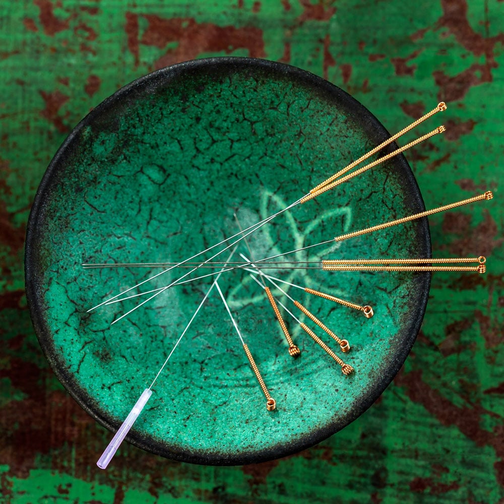 Acupuncture